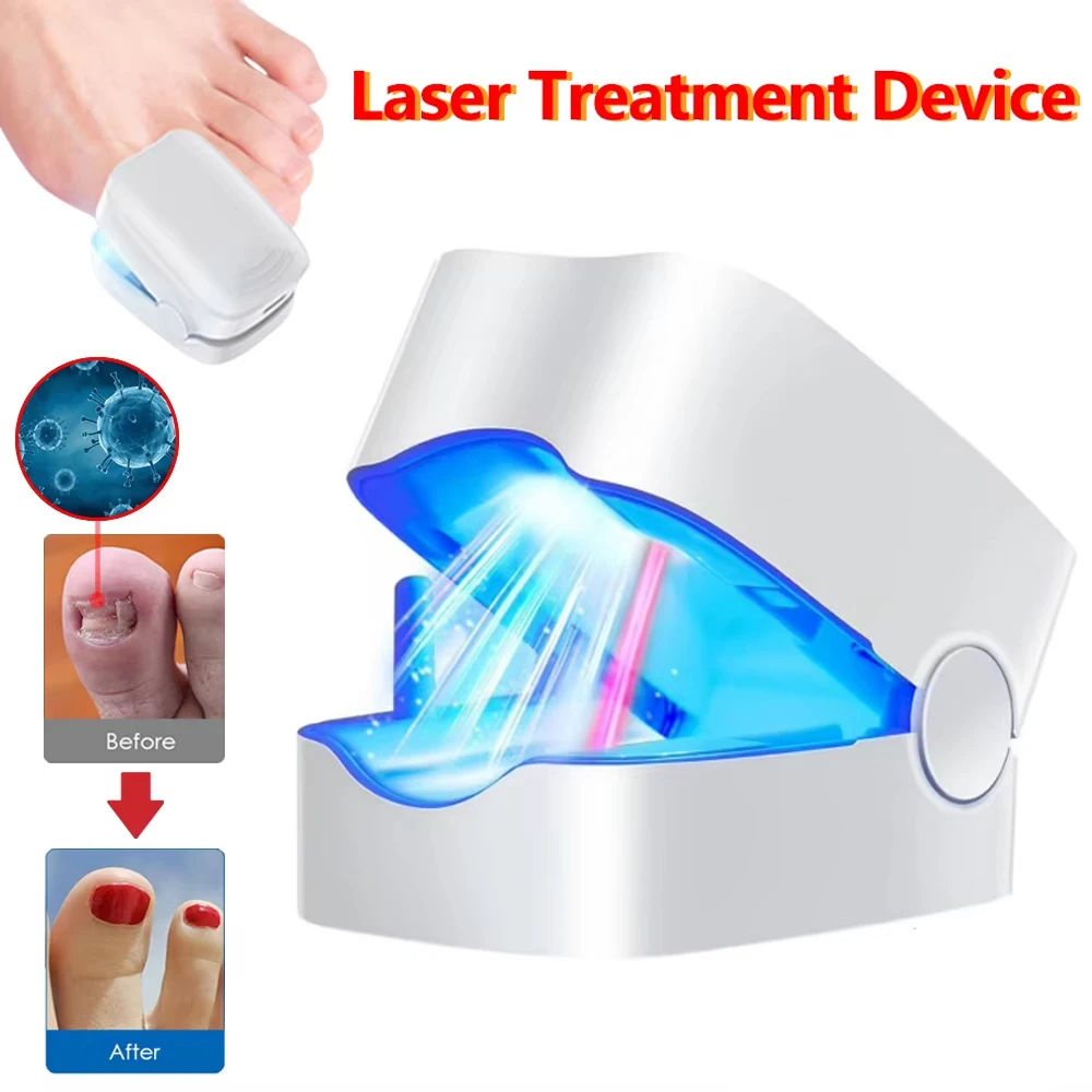 Nail Fungus Laser Treatment Device