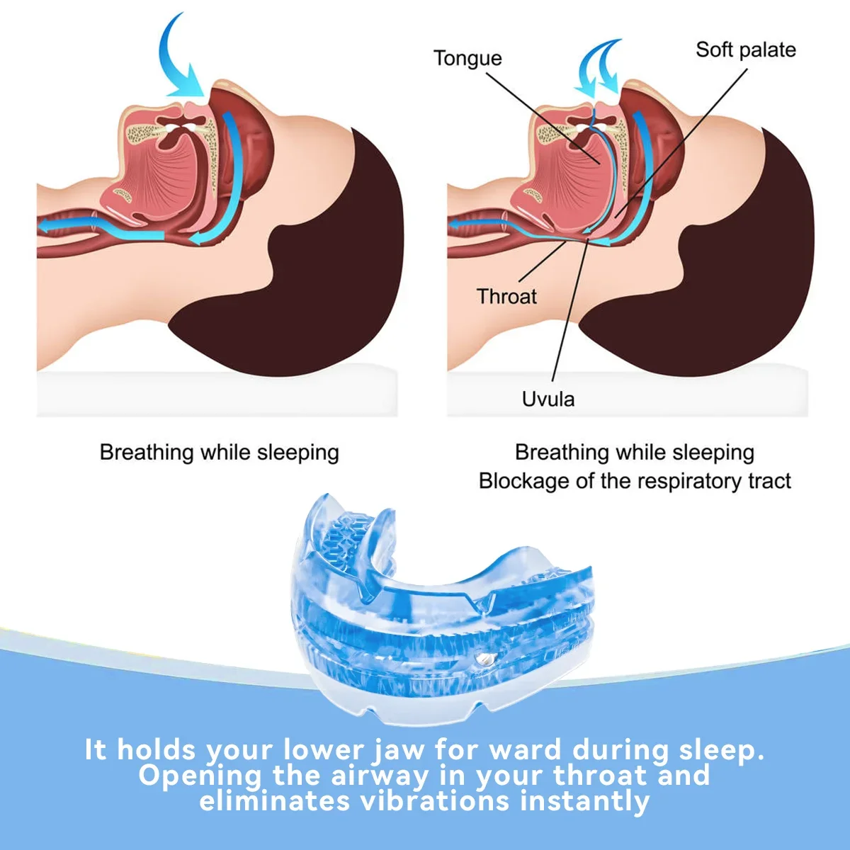 Adjustable Anti Snoring Mouth Guard