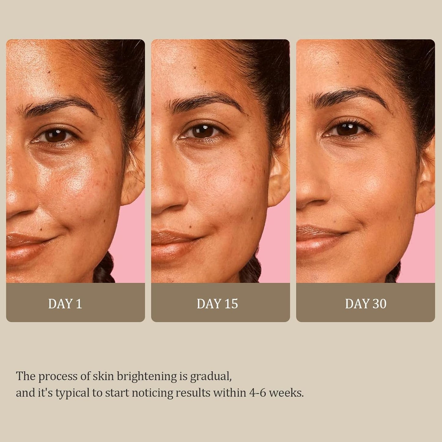 Turmeric Kojic Acid Glow Soap Dark Spot Acne Removal