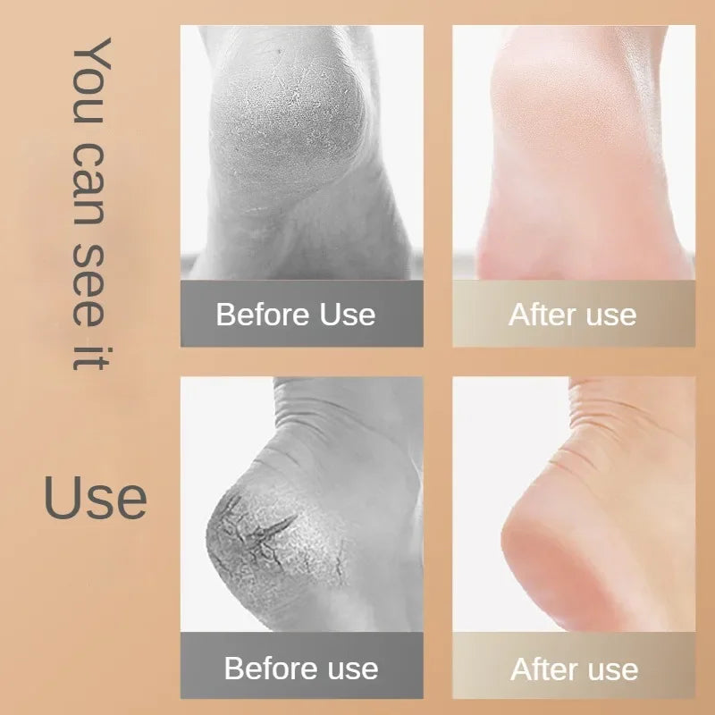 2Pcs Heel Protective Foot Cover Foot Heels Socks