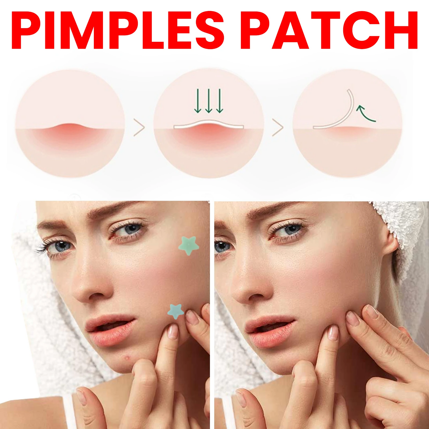 200Pcs Repair Acne Patch Fade Blemishes Pimple Marks