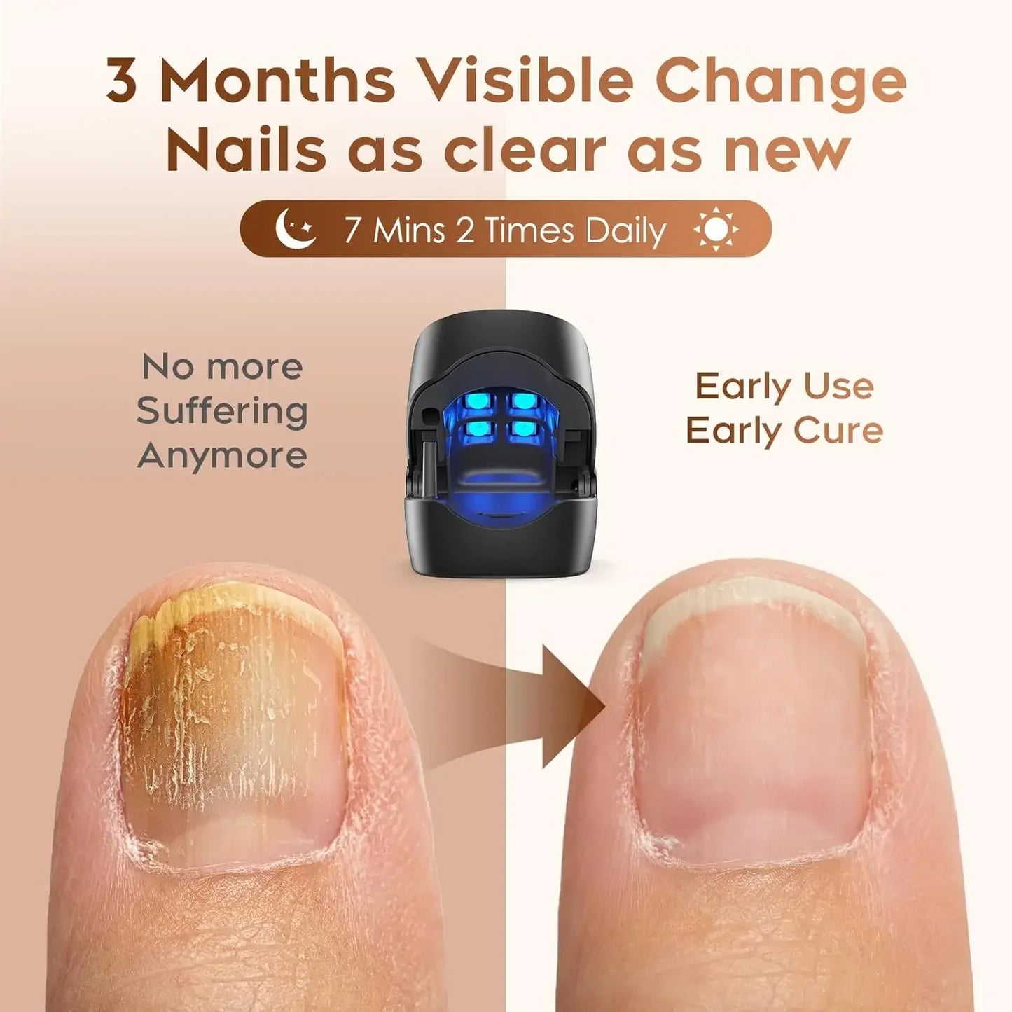 Nail Fungus Treatment LED Laser Device for Cleaning