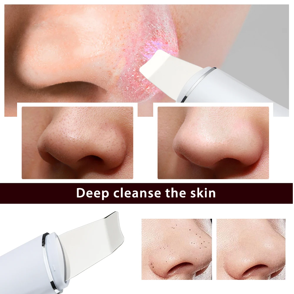 Ultrasonic Skin Scrubber Deep Face Cleaning