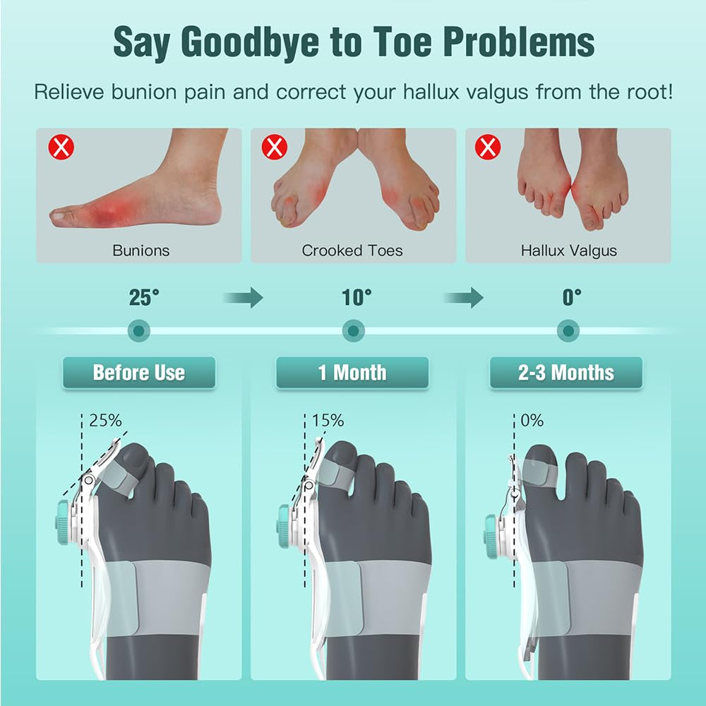 Bunion Corrector Adjustable Hallux Valgu Big Toe