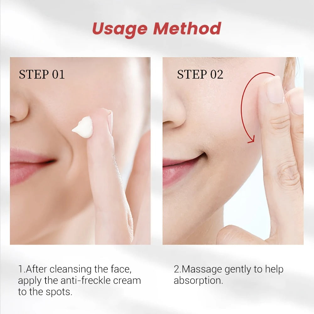 20g Whitening Freckle Cream Remove Dark Spot