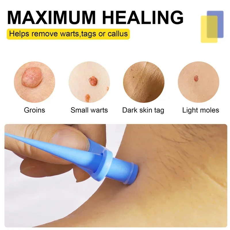 1 Set Skin Tag Removal Kit Skin Mole Wart Remover