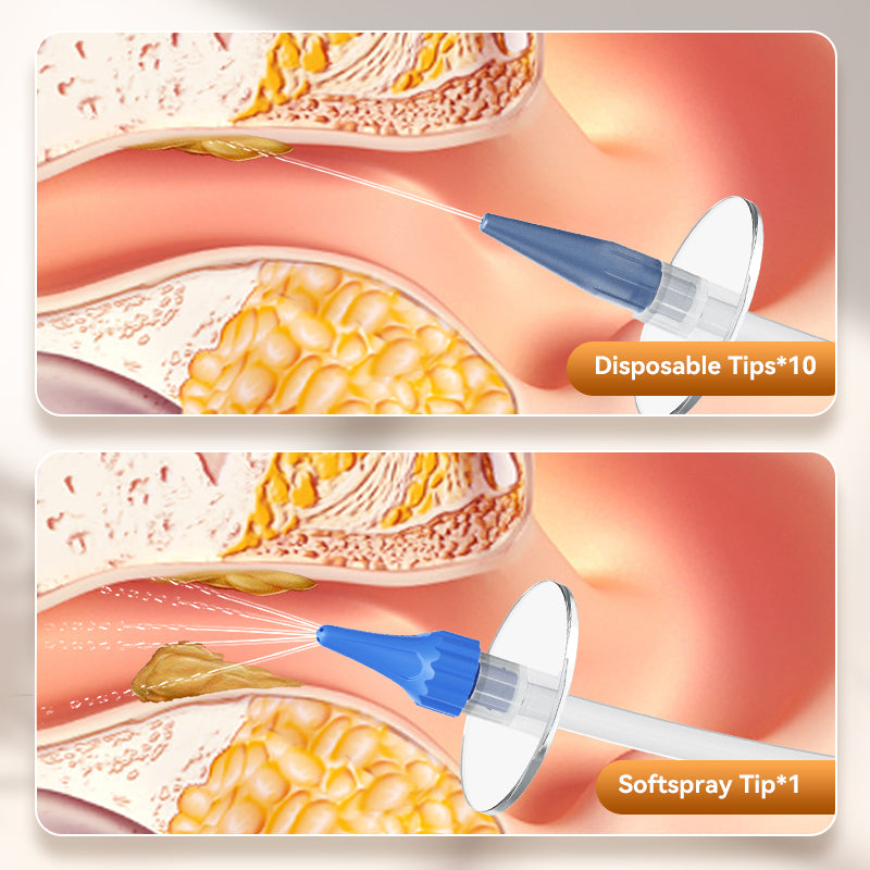 Ear Wax Removal Manual Ear Irrigation Flushing