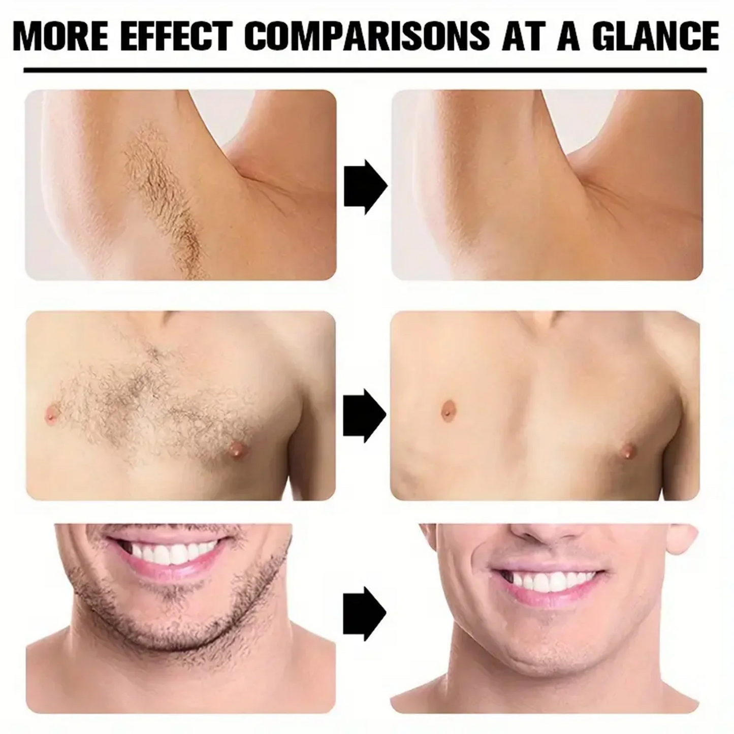 Hair Removal Cream Permanent Epilator Cream