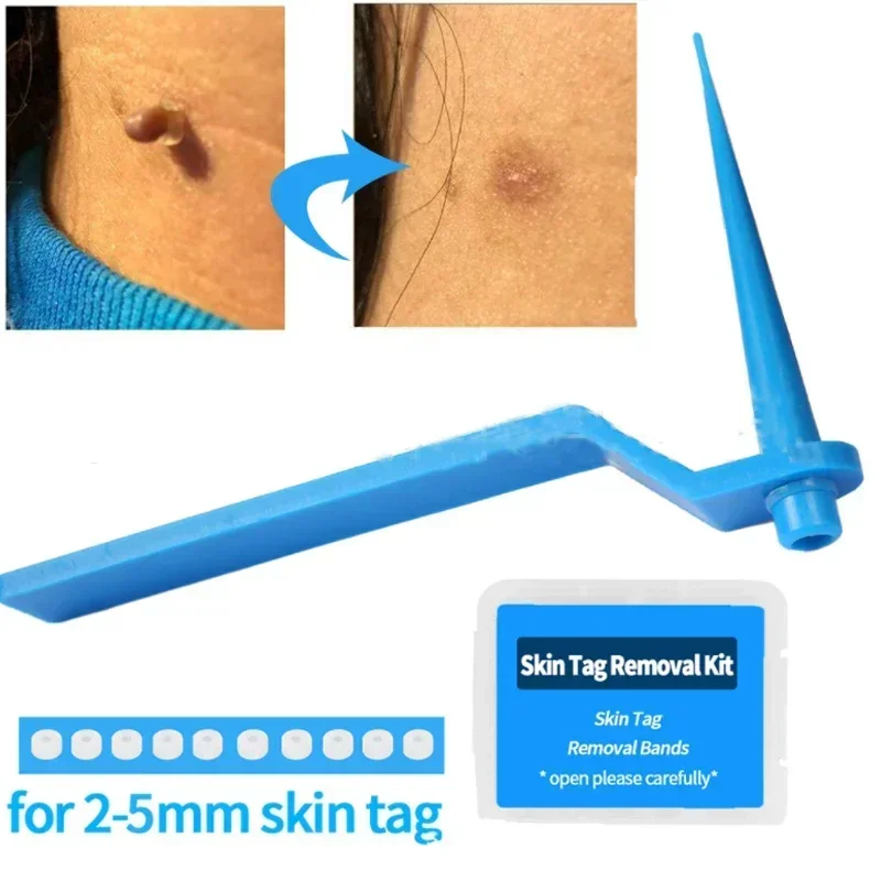 1 Set Skin Tag Removal Kit Skin Mole Wart Remover