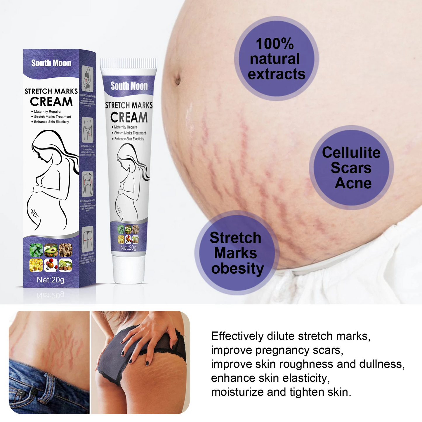 Remove Pregnancy Stretch Marks Cream