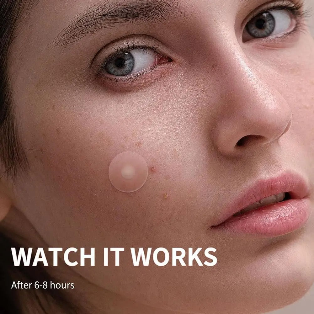 360pcs/600pcs Pimple Patch Acne Invisible Acne Removal